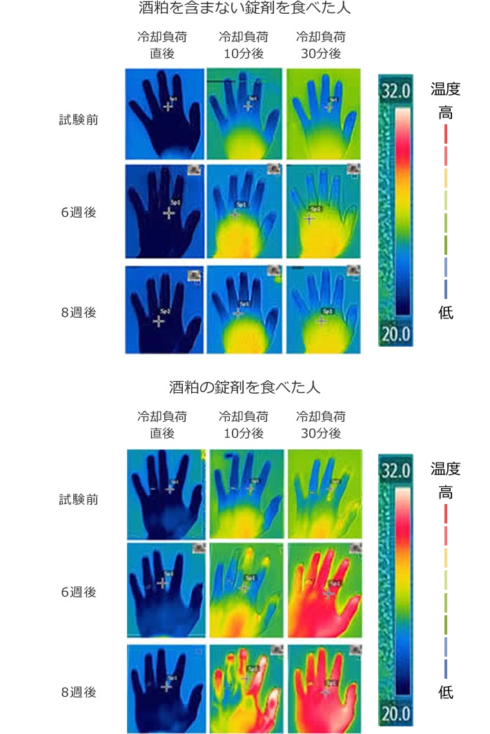 図3 冷却負荷試験後の手の表面温度