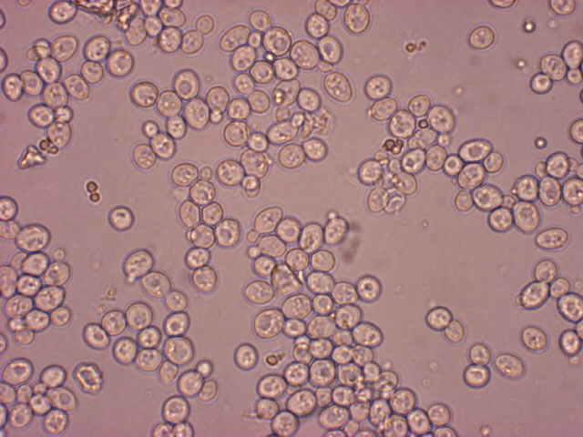「糖質ゼロ」の醸造に用いる酵母